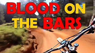 Blood on the Bars | MTB Power Anthem | Mountain Bike Trail Banger | DJ Druid
