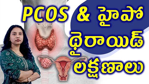 PCOS & హైపో థైరాయిడ్ లక్షణాలు Common Signs Symptoms of PCOS Hypothyroidism Homeopathy Treatment Cure