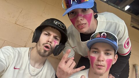 IRL SUNDAY BASEBALL GAME ⚾ 💪🏽