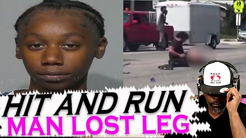 19 yr Old Reckless Driving Causes A Man To Lose His leg, Man Has Sex With Student