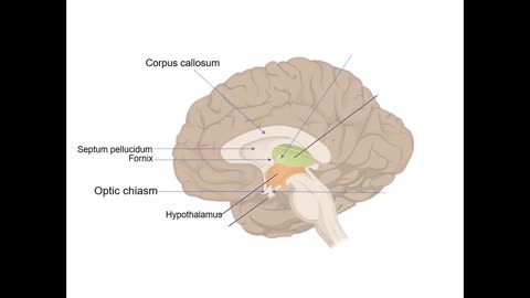 Practice identifying structures of the Brain