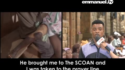 12 YEAR-OLD HEALED OF SCORCHING HOT WATER BURNS!