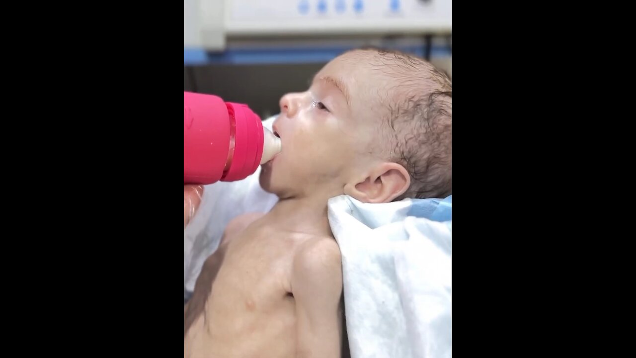 premature baby