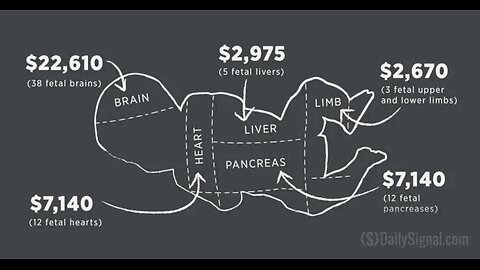 Epstein's AI Baby Farms...Mind Unveiled