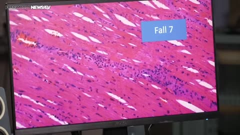 German Scientists Show Magnified Images Of Massive Vaccine Damage