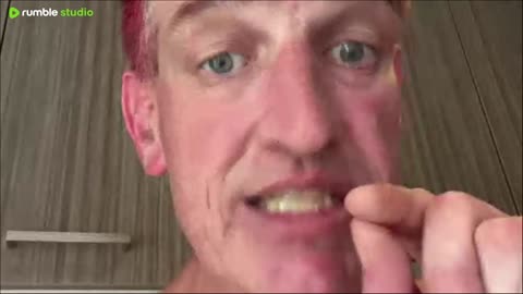 You 304s are no different than the bondi terriost