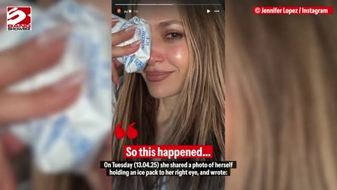Jennifer Lopez experiences a facial injury during rehearsals