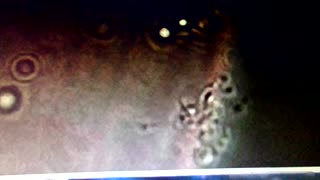 Time Release Death Injections 1/28/26: