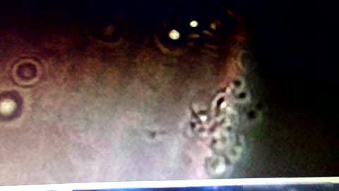 Time Release Death Injections 1/28/26: