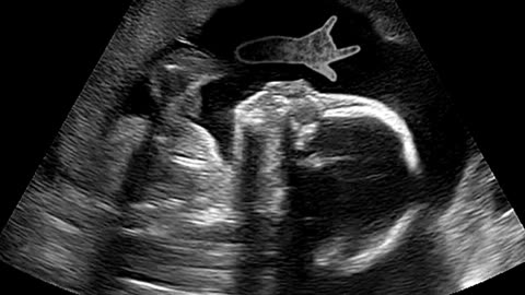 Cutting-Edge IVF & ICSI Fertility Solutions