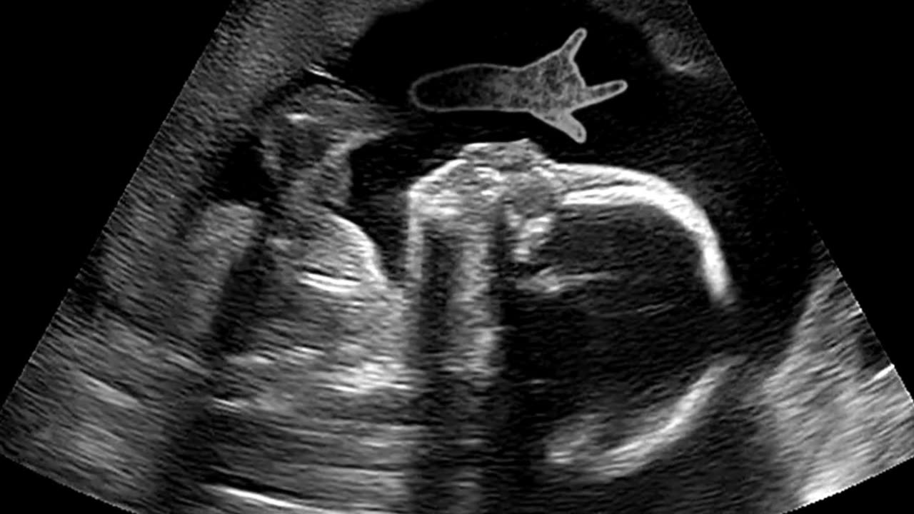 Cutting-Edge IVF & ICSI Fertility Solutions