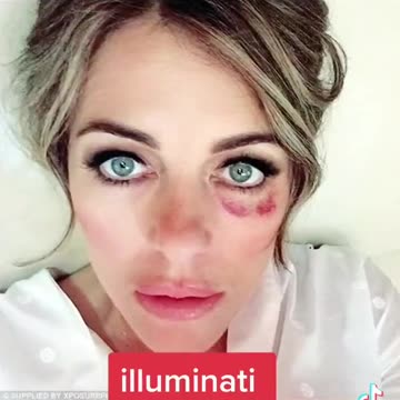 The “Black Eye” club,