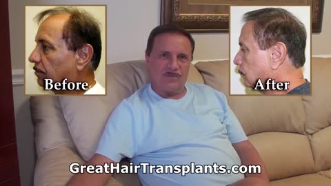 Top Hair Transplant Doctors for Men and Women in Dayton, Ohio - promo