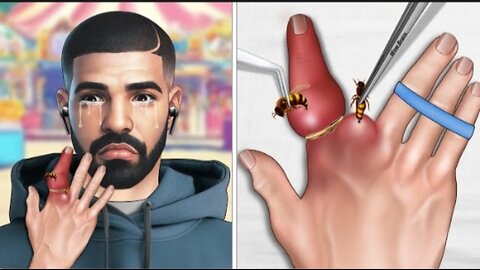 ASMR | Animated ASMR | Help Drake Fix The Ring Stuck By The Bee Sting