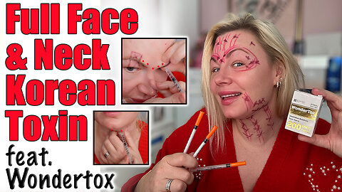 Full Face and Neck Korean Toxin, Wondertox! AceCosm.com and code Jessica10 Saves