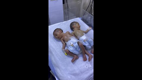 Miracle Twins in NICU – Tiny Fighters on the Warmer! ❤️👶👶