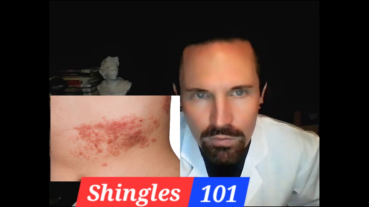 Shingles 101 The Basics