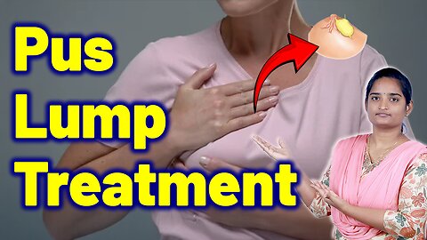 Breast Pus Lump Treatment Methods | Infected Breast Lump, Breast Boil Homeopathy Medicine & Surgery