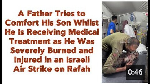 "Father Comforts Son During Treatment for Severe Burns"