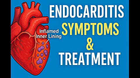 Endocarditis Symptoms & Treatment | Protect Your Heart from Deadly Infections! | HealWell Guide