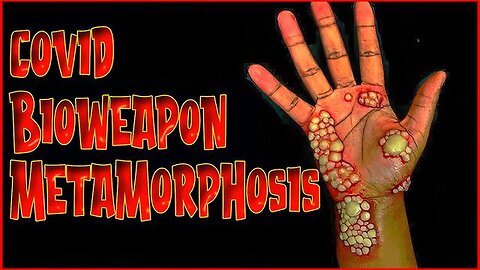 "Unveiling the Impact of 13 Billion Injections: Pain Predominant in White Christian Nations"