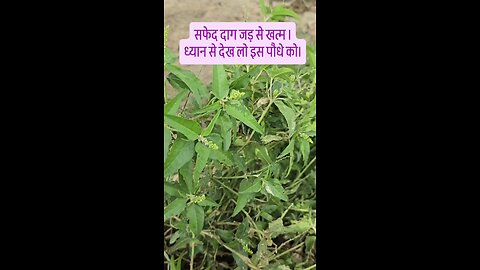 विटिलिगो (Vitiligo) सफेद दाग ।