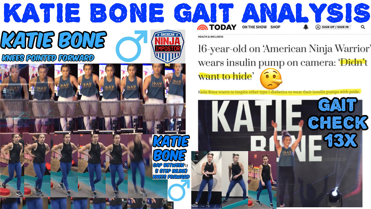 KATIE BONE GAIT ANALYSIS