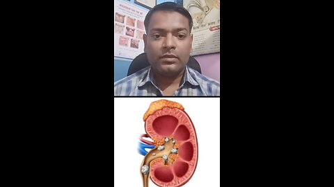 गुर्दे की पथरी का इलाज ।