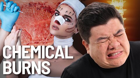 Botched Nose Job Gave Her Chemical Burns W/ Snaxx Poole | Hardly Legal