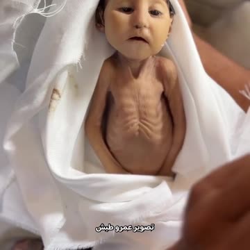 The infant Ghadir Brikeh (5 months old) passed away at Nasser Medical Complex