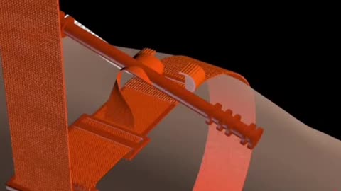 How To Stop Bleeding In Emergency, Life Saving Device 3D Animation