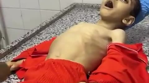 9 children have died from hunger in the last 24 hours alone. Your and all the accomplices G@za