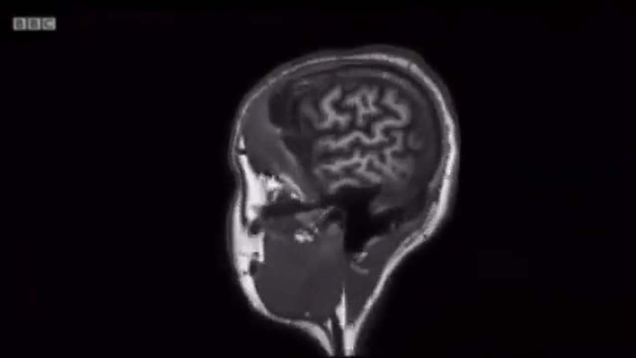 HOW JUNK FOODS ALTER THE NEURAL CONNECTIONS IN YOUR BRAIN
