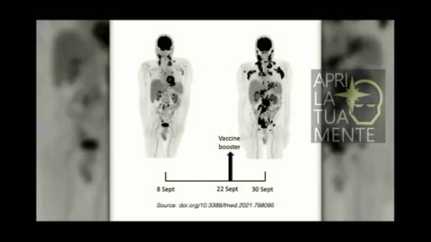 Nano Capsule iniettate - Covid 19 Vaccino -Video 2