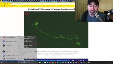 Fibrils in 'Vaxxed' Blood