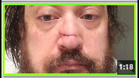 "Man Experiences Stroke 36 Hours After Pfizer Vaccine Administration"