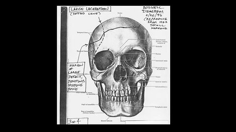 JFK The Medical Cover Up