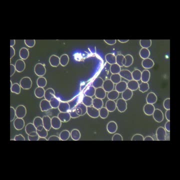 VACCINE INJURY LIVE BLOOD ANALYSIS