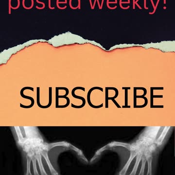 A Love Story in X-Rays