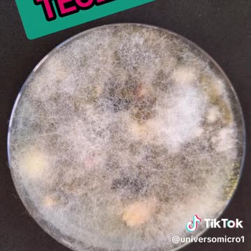 Quantidade de bactérias no teclado