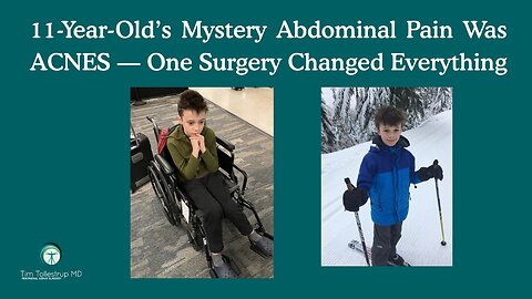Hidden Cause of His GI Pain: Anterior Cutaneous Nerve Entrapment