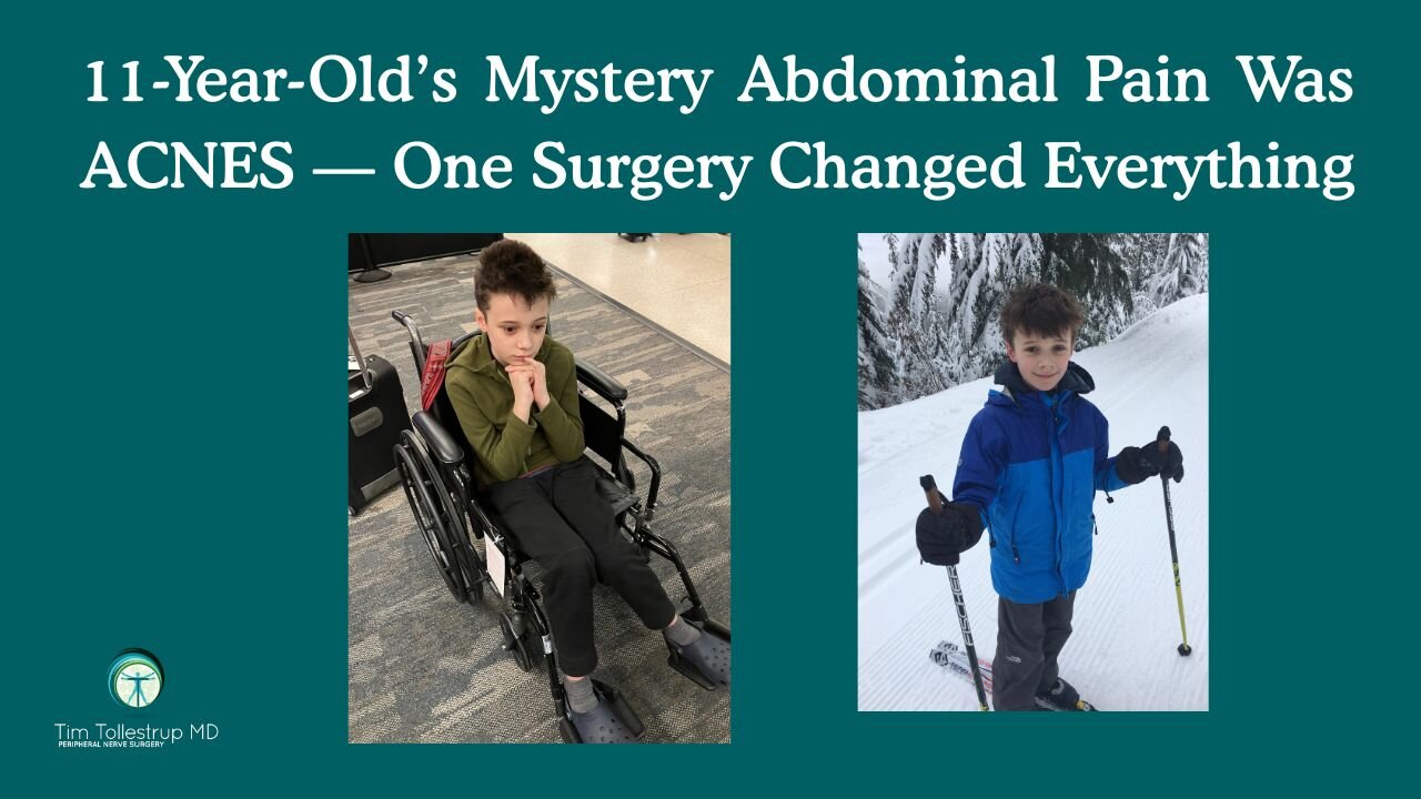 Hidden Cause of His GI Pain: Anterior Cutaneous Nerve Entrapment