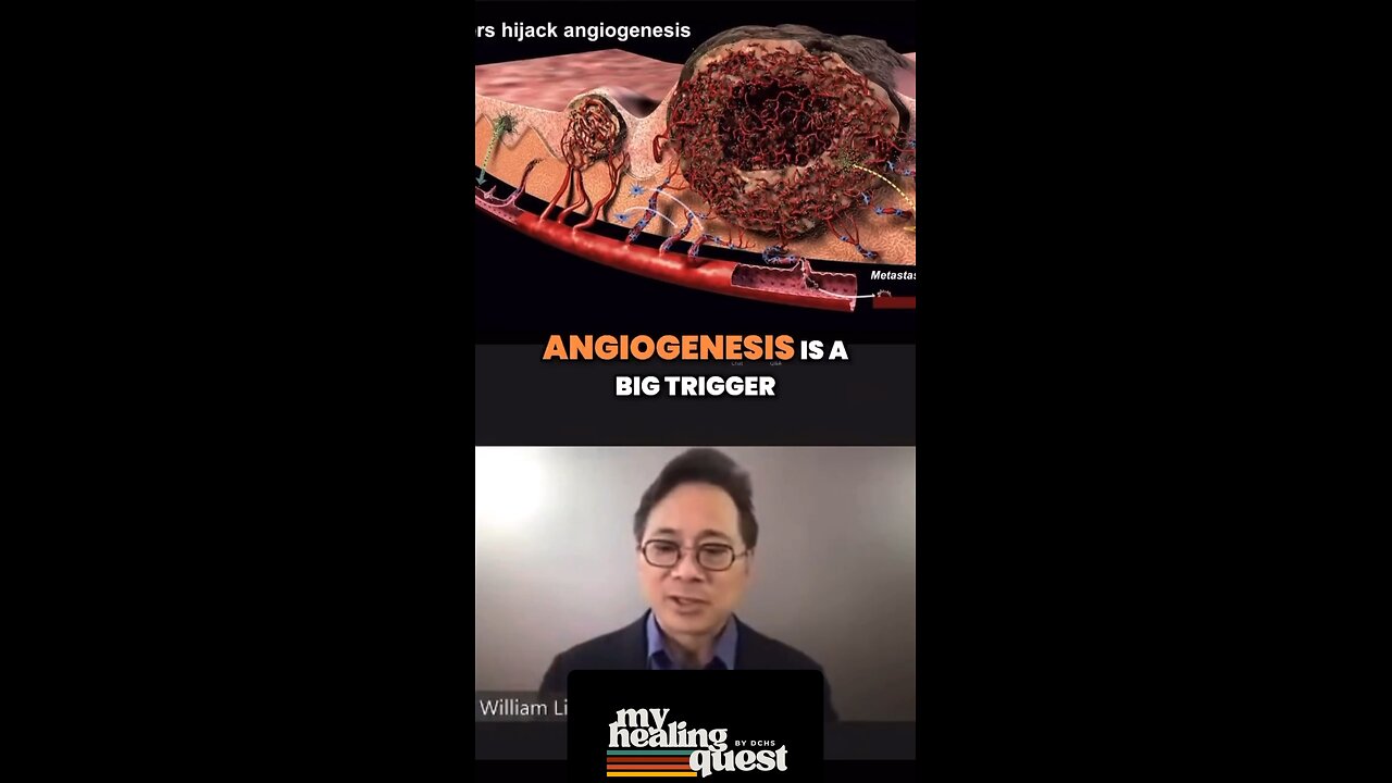 The “anti-angiogenic diet” is often considered a plant-based diet with limited meat consumption