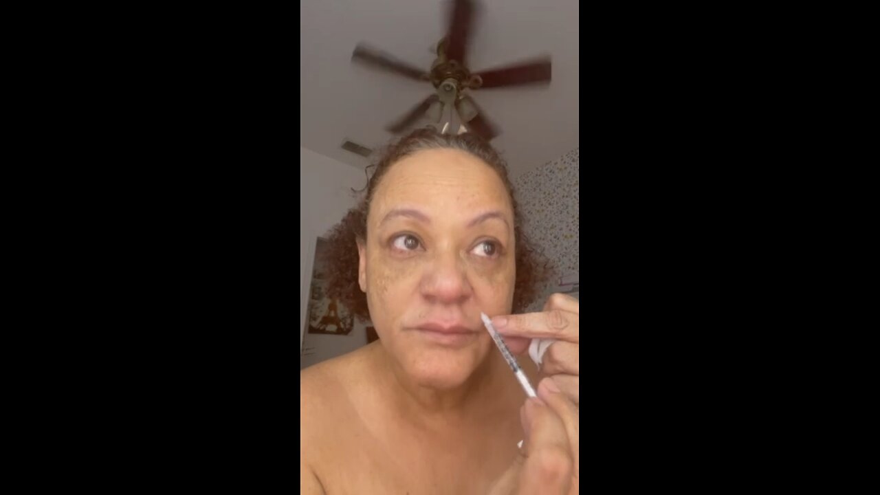 DIY tinkerbell nose with tox part 2
