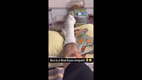Nah bro mocking him