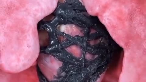 Óxido de Grafeno en el sistema pulmonar y en el corazón