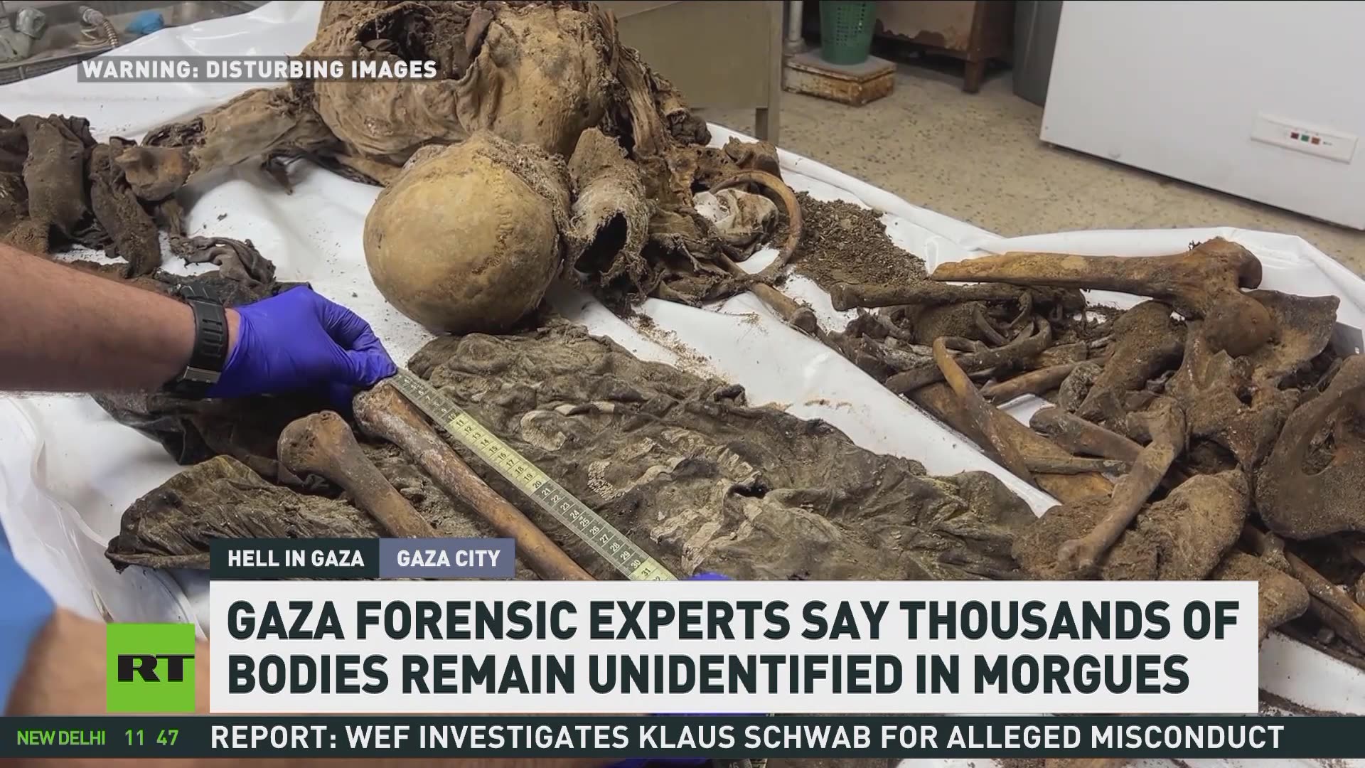 Unclaimed Souls: Inside the Morgue of Al-Shifa Hospital