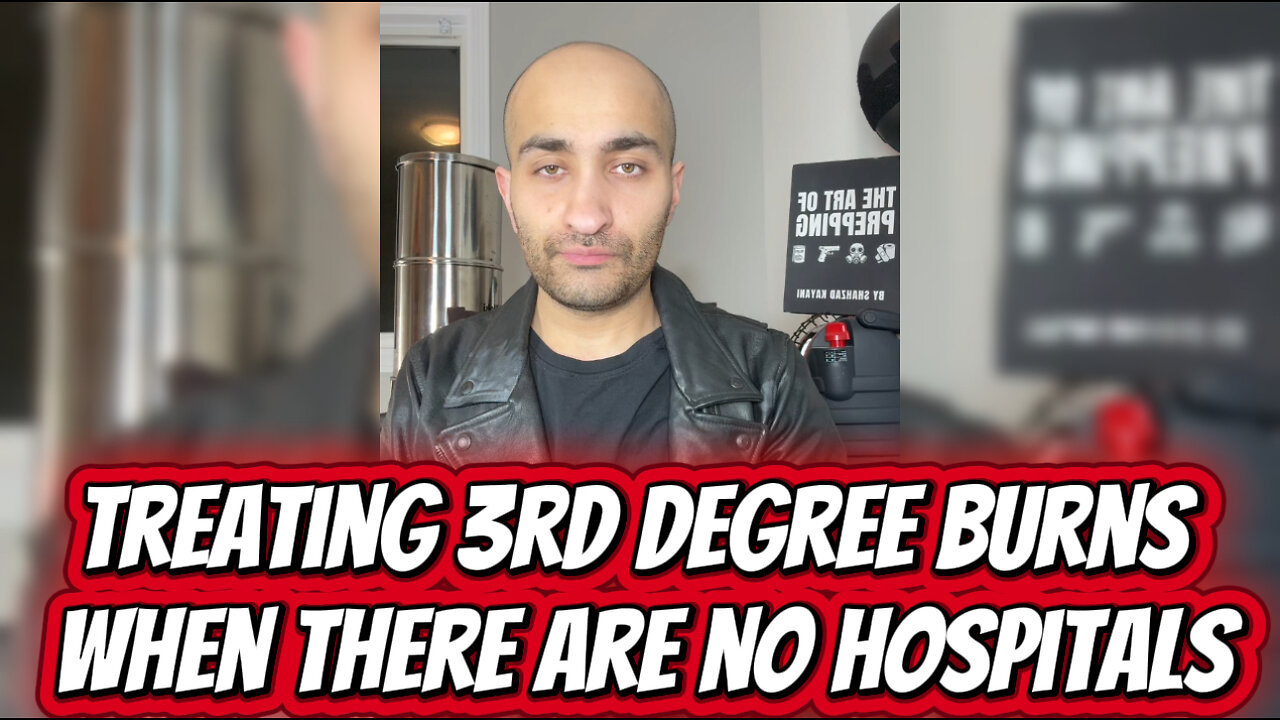 Treating 3rd Degree Burns in a Post Collapse Scenario - No Doctors & No Hospitals