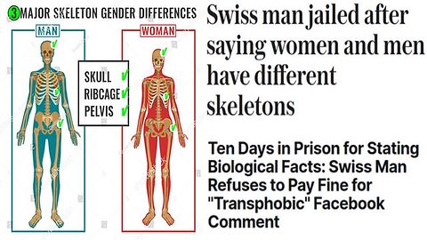 Swiss Man Jailed After Saying Women And Men Have Different Skeletons