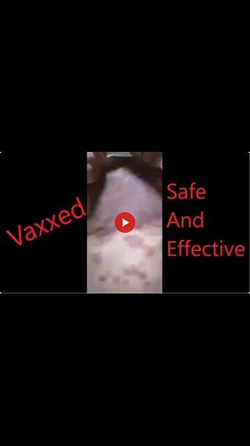 Viewer discretion advised. Extreme covid vax reaction!